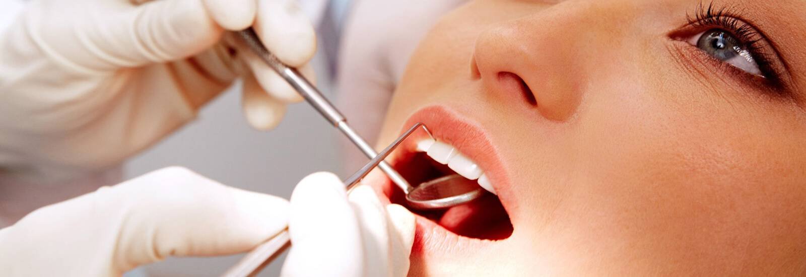 Dental Fillings