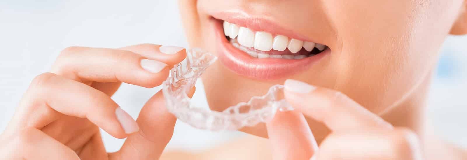 Clear Aligners (Invisible Braces)