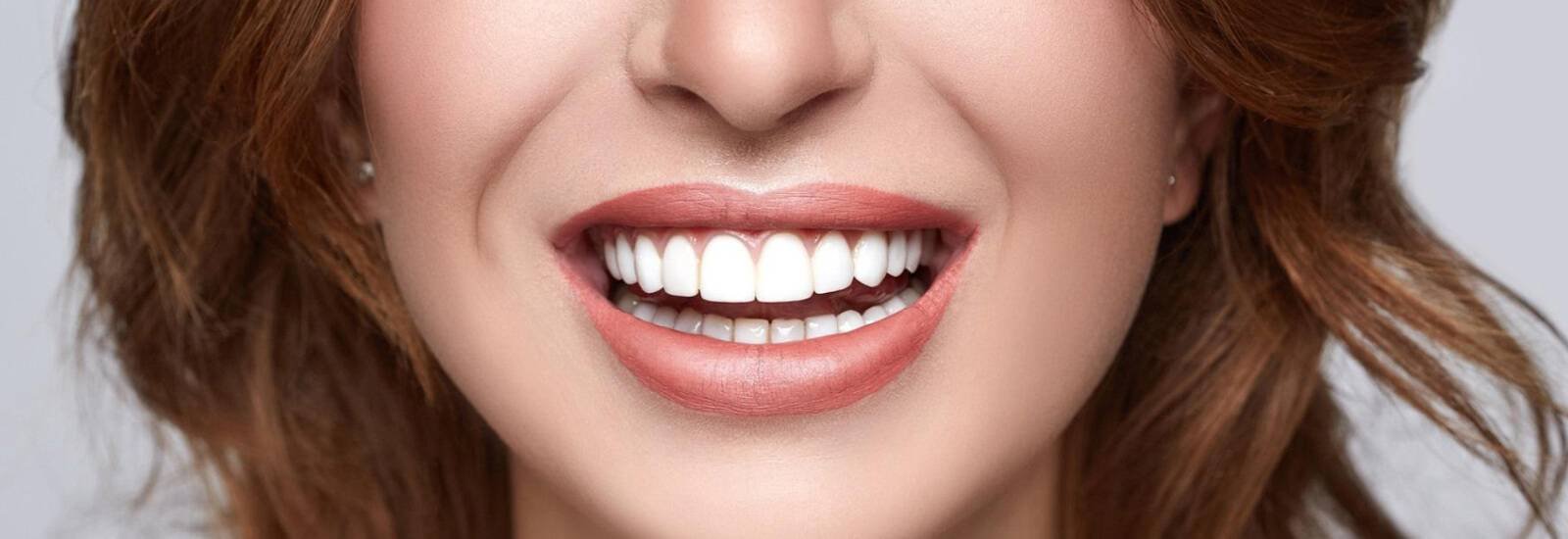 Smile makeover treatment