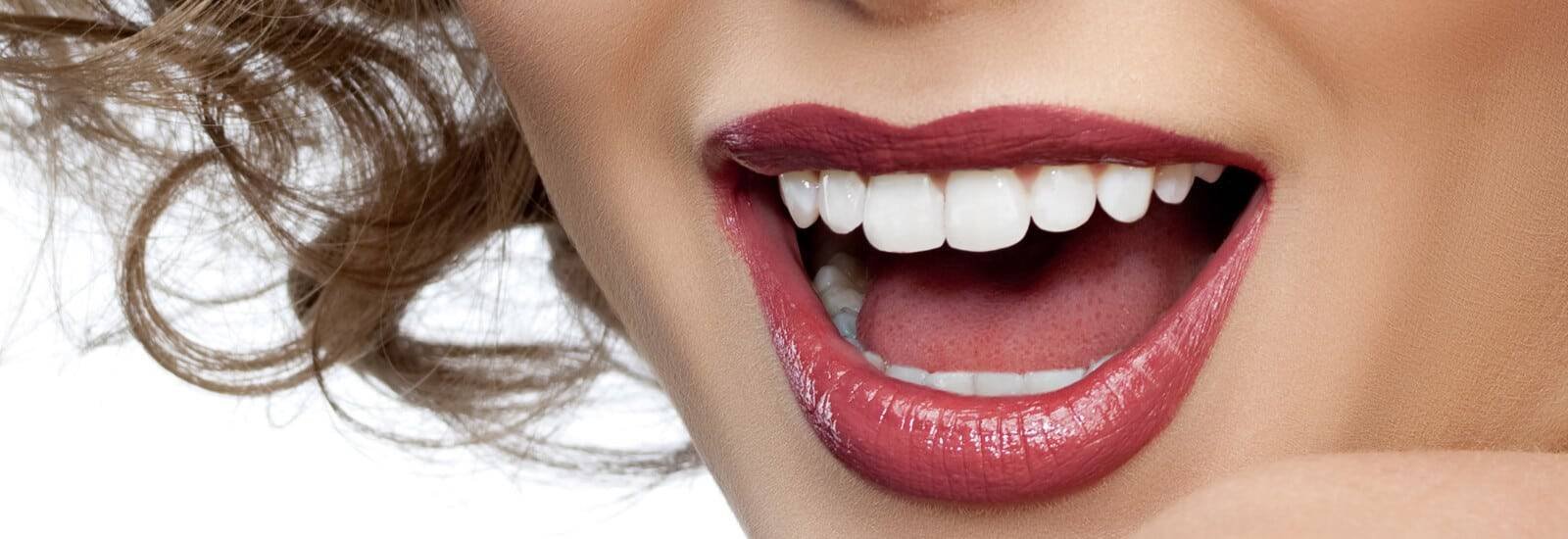 Teeth Whitening / Bleaching